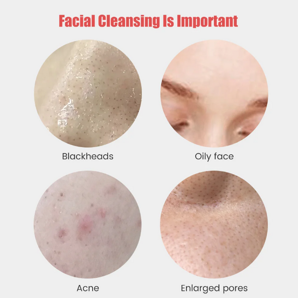 LumaSkin Sonic Cleansing Brush